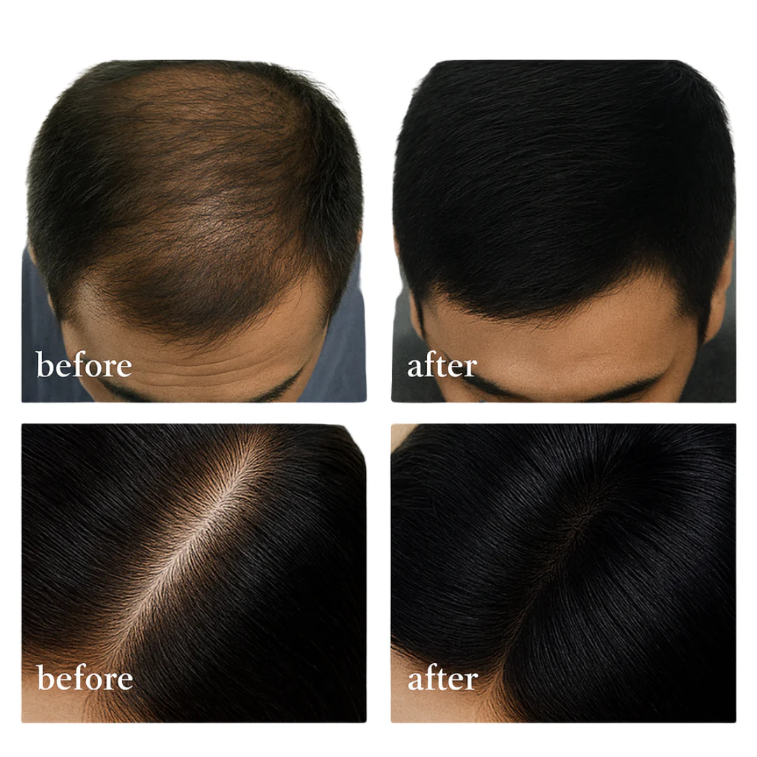 Seven Green Soap for Hair Loss Treatment - Image 2